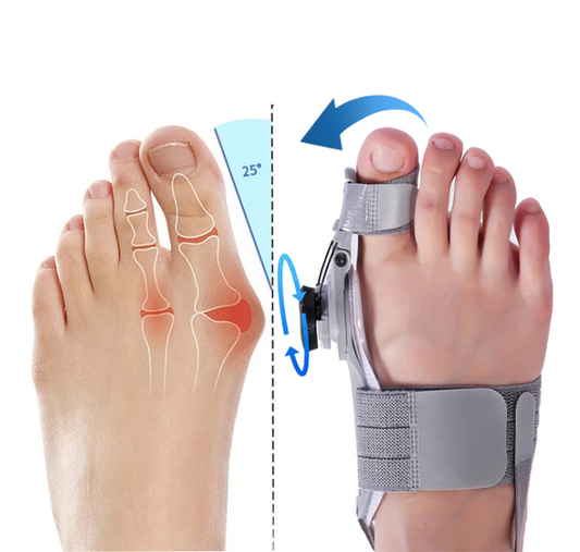 Treamedy™ Bunion Fix - Natural At- Home Bunion Relief